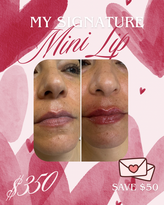 Mini Lip
